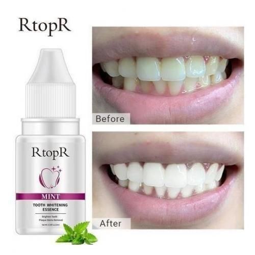 Essence de Blanchiment des Dents à la Menthe, Élimination des Taches de Plaque Dentaire