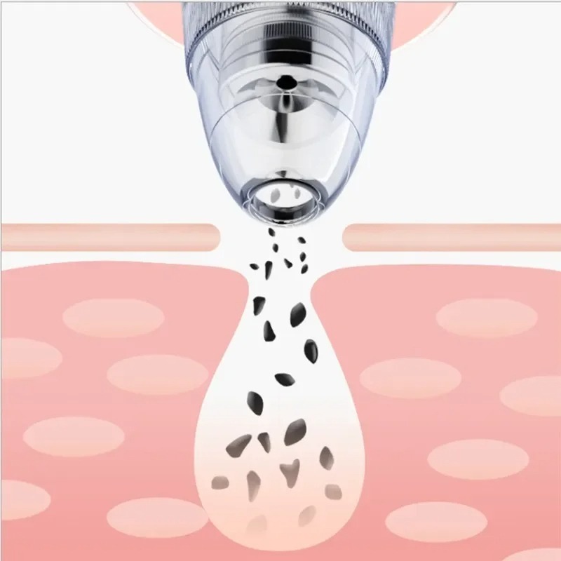 Image de Cleanser Électrique pour Points Noirs - Élimination Facile et Douce des Imperfections de la Peau - Unbranded