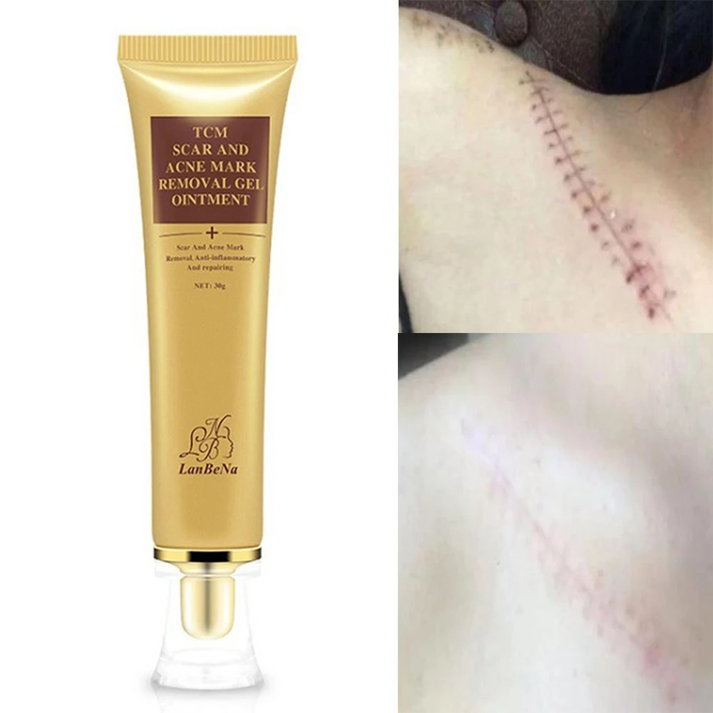 Gel TCM pour Cicatrices et Marques d'Acné - Réduit les Cicatrices et Améliore l'Apparence de la Peau